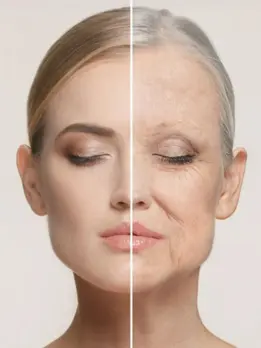 Two shots of a woman show the removal of age spots, wrinkles, and fine lines, but with skin tones.