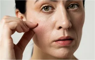 A woman holding her face with noticeable wrinkles shows the before and after of anti-aging therapy.