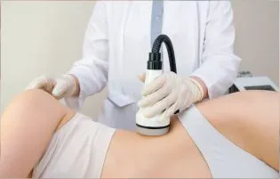 A woman undergoing stretch marks removal treatment from the best dermatologists skin doctors.