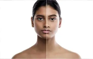 A woman's body displays both before and after receiving skin tan removal treatment procedures.