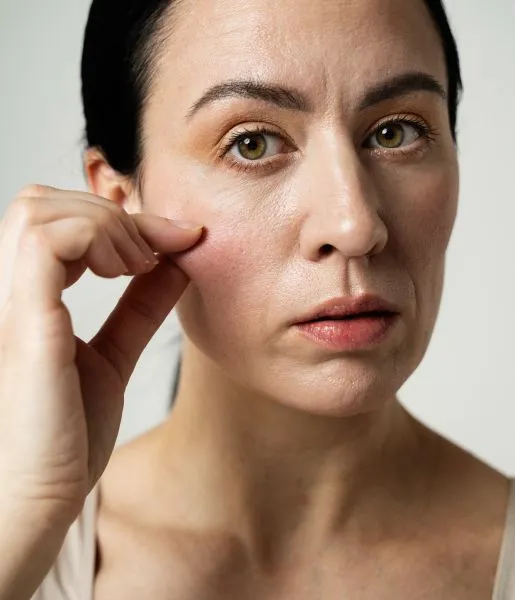 An individual with a pimple on their face seeks treatment at the Anti-Aging Treatment Clinic.