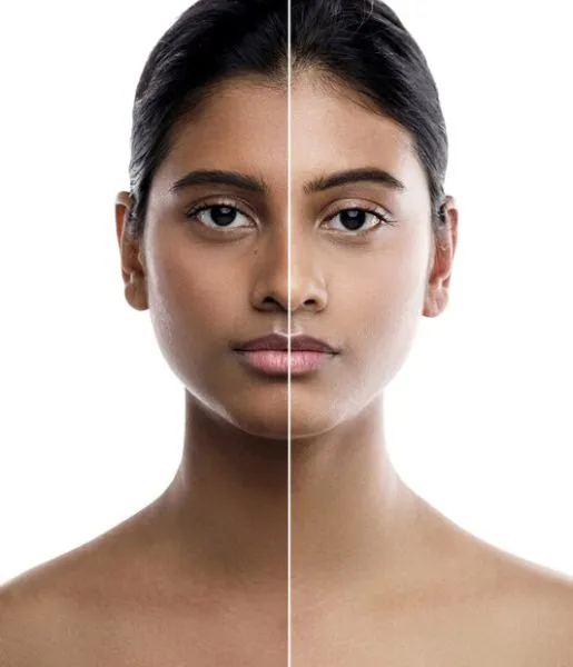 The body of a women is visible both before and after dark skin tan removal treatment procedures.