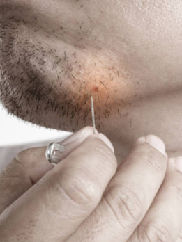 A man is using a safety pin to remove the tiny hairs in his mustache and beard in front of a mirror