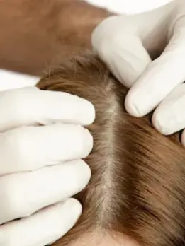 A doctor trims an individual's hair, and the patient receives less healing time with treatments.