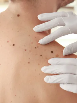 A man undergoing an examination for relief from pain while wearing white gloves on his back.