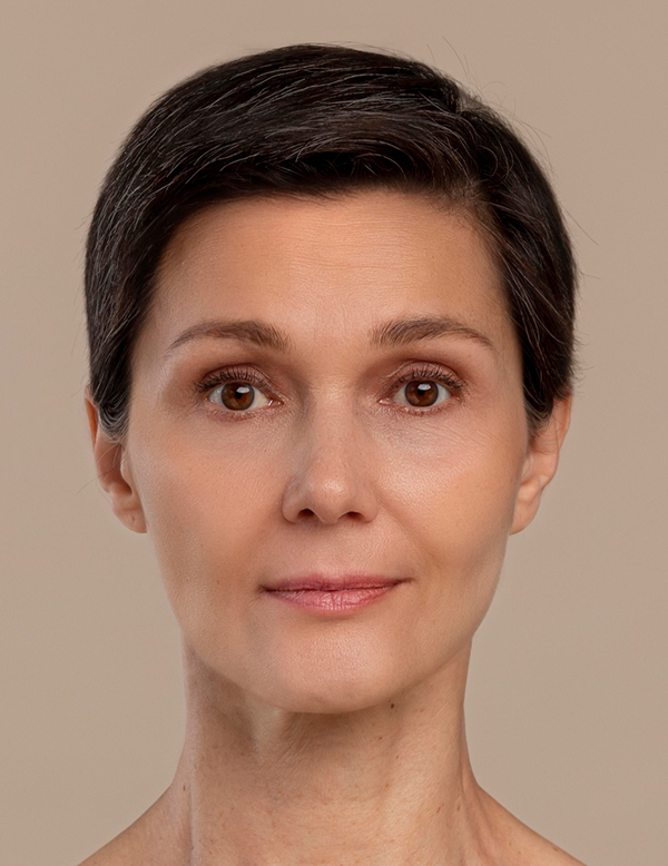 Facial skin improvement after anti ageing treatment