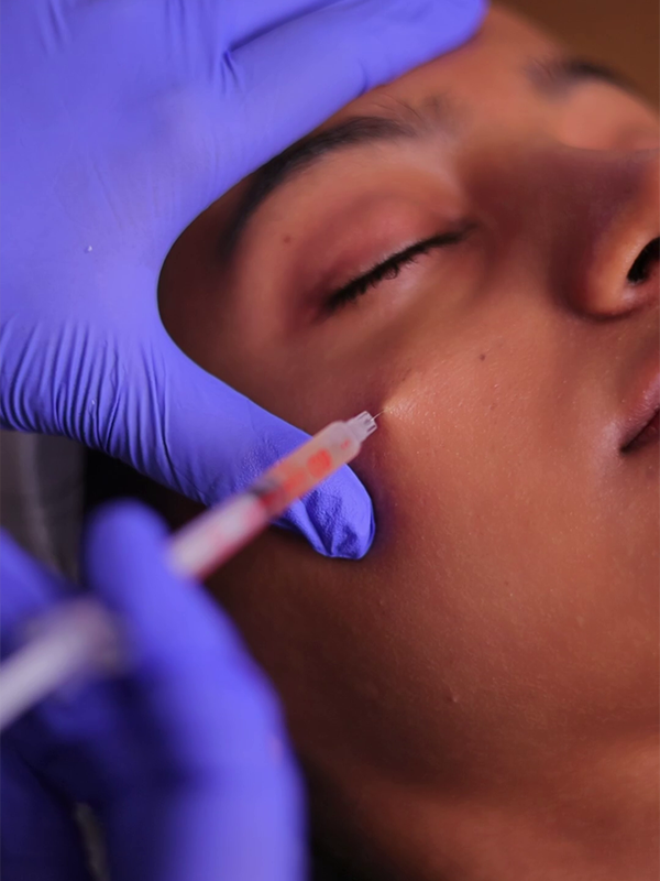 Plasma gel skin rejuvenation procedure