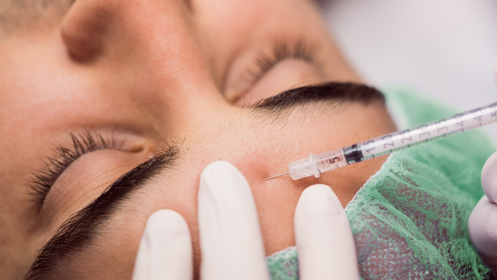 Botox injection for wrinkle reduction on forehead