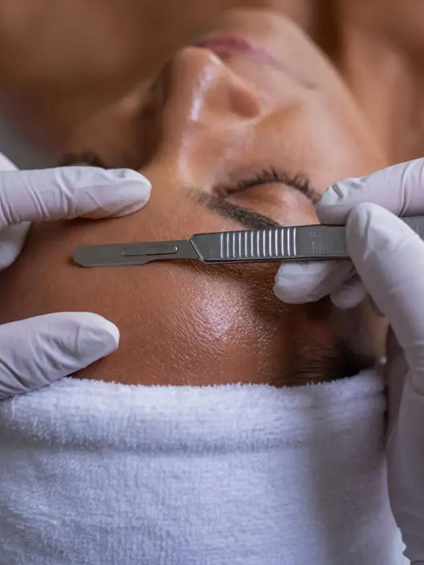 Facial dermaplaning procedure