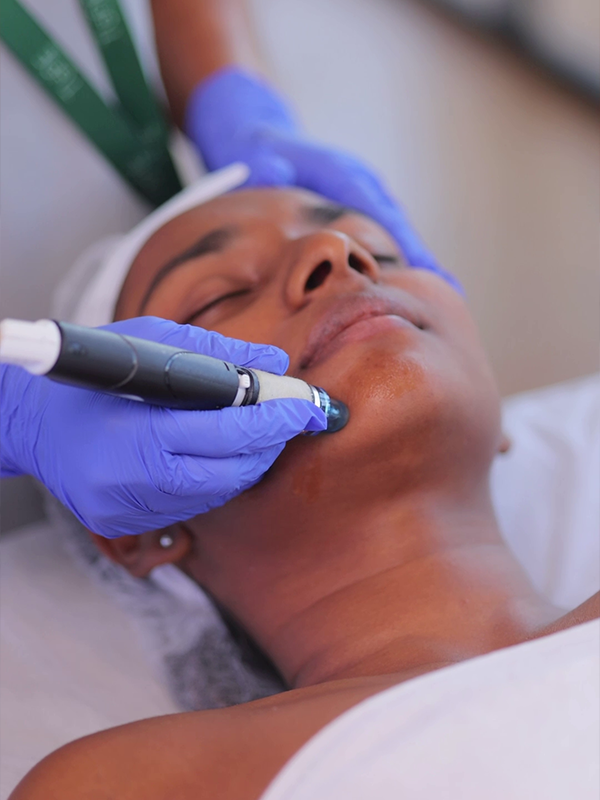 Deep cleansing hydrafacial procedure