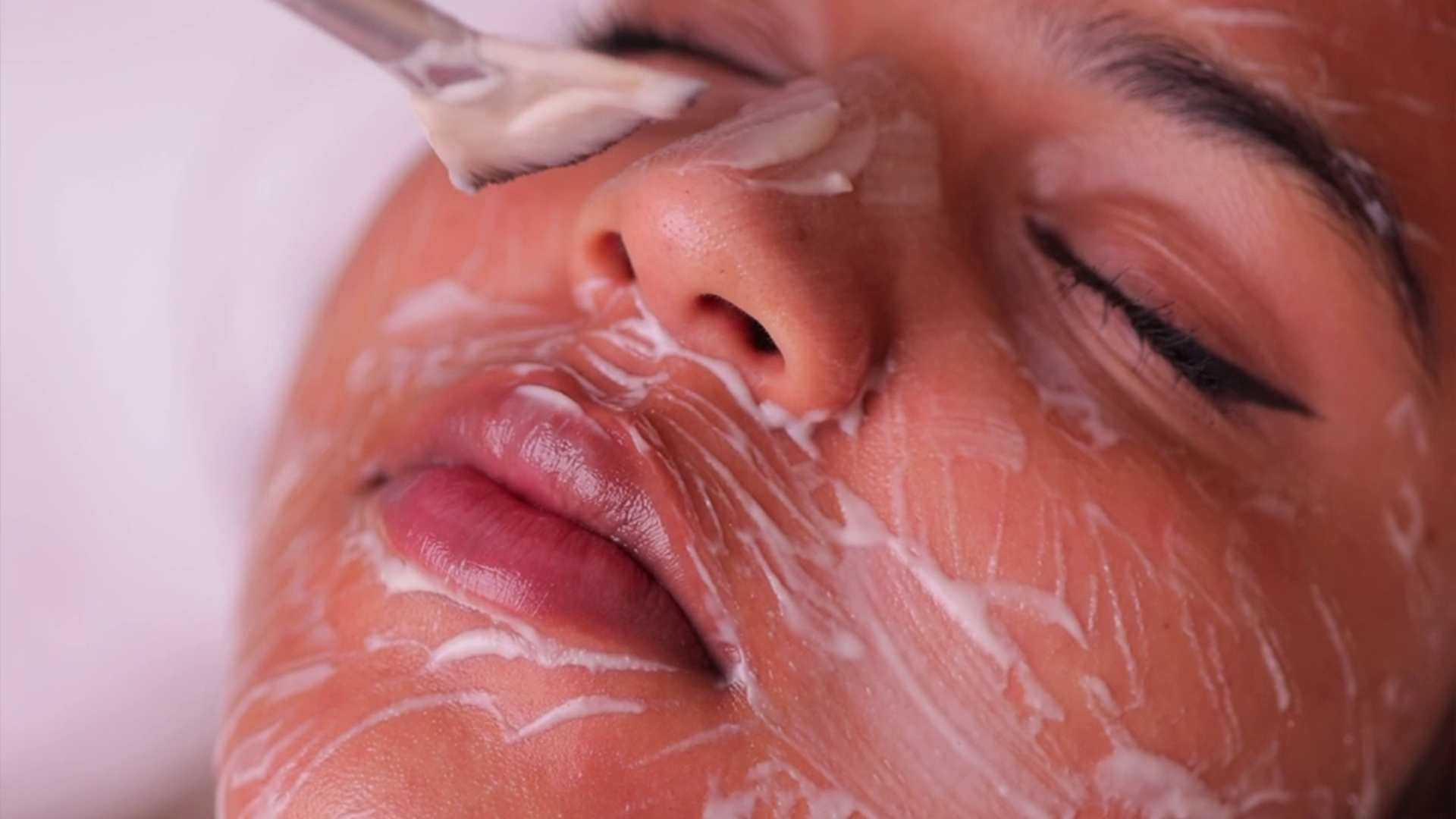 Melasma treatment procedure