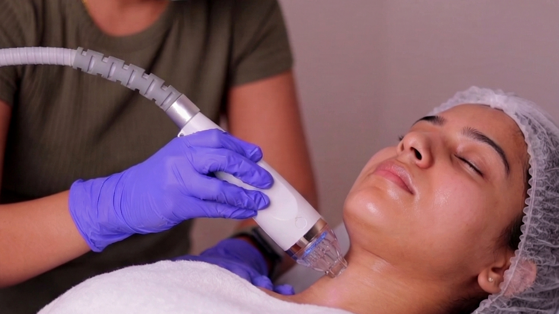 HIFU device being used for face skin tightening treatment