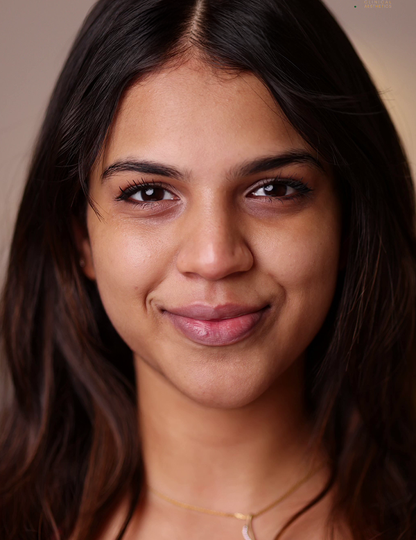 Face with dull and uneven skin tone before treatment