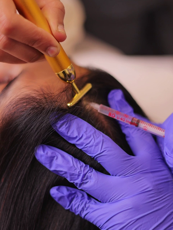 PRF hair regrowth therapy
