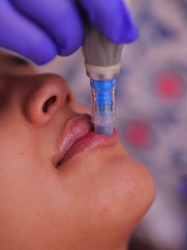 Advanced skin renewal therapy