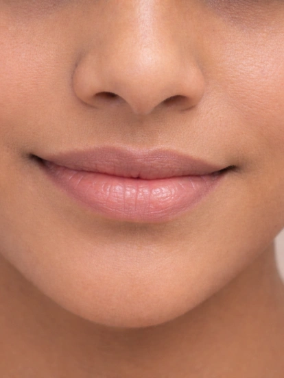 Smooth upper lip skin after treatment