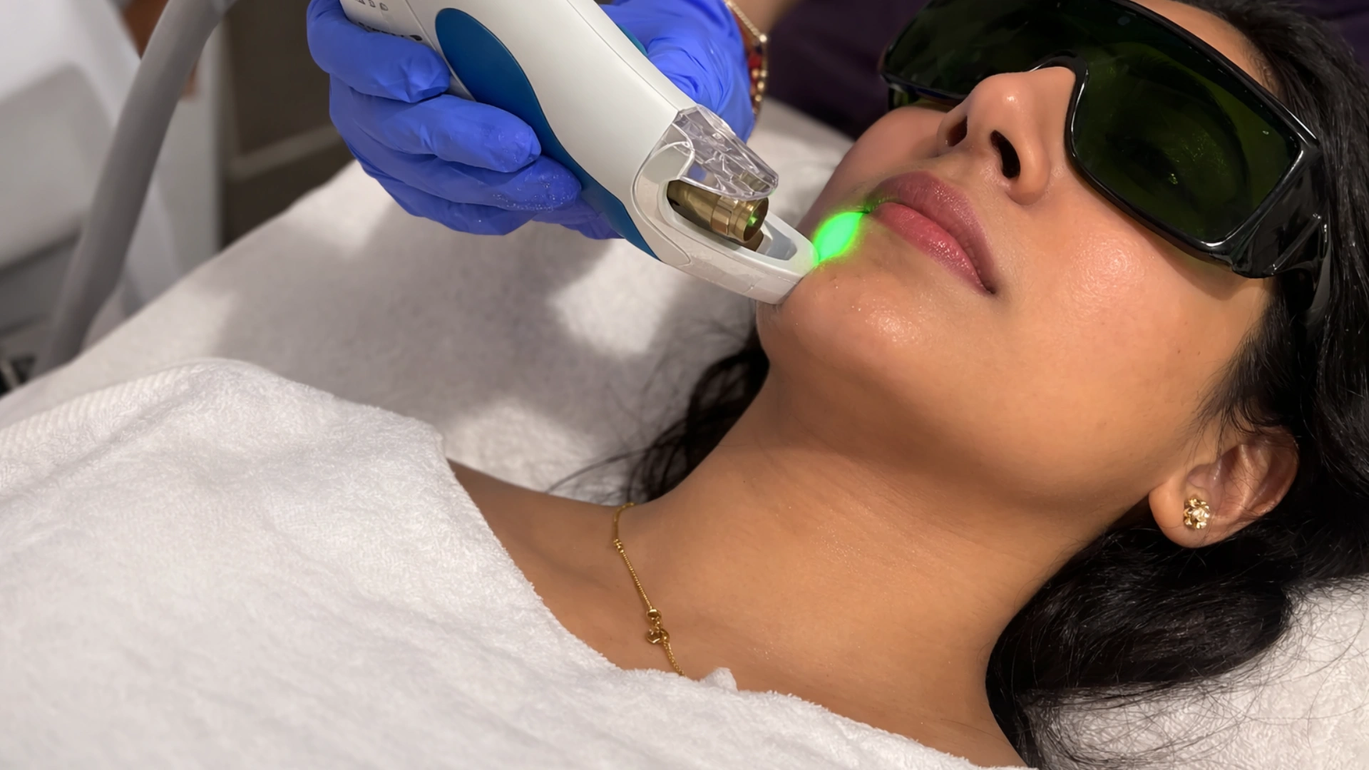 Facial hair removal treatment