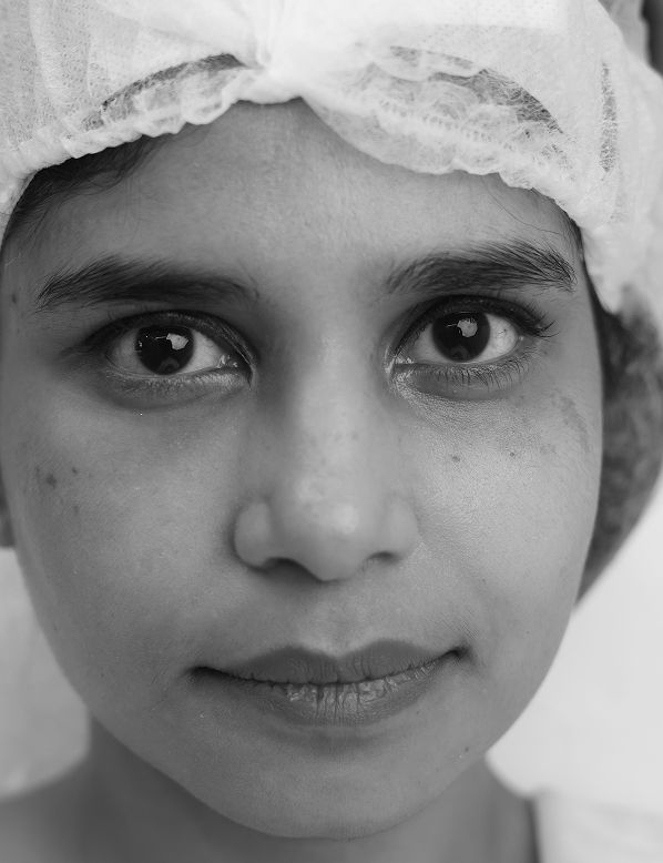 Face appearing firmer and smoother after skin tightening treatment