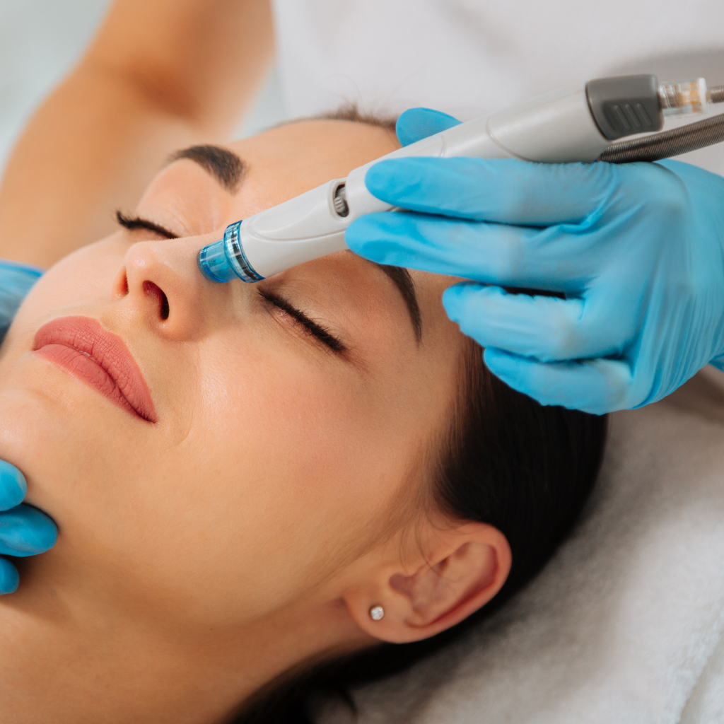 What Is HydraFacial: The Ultimate Skincare Treatment