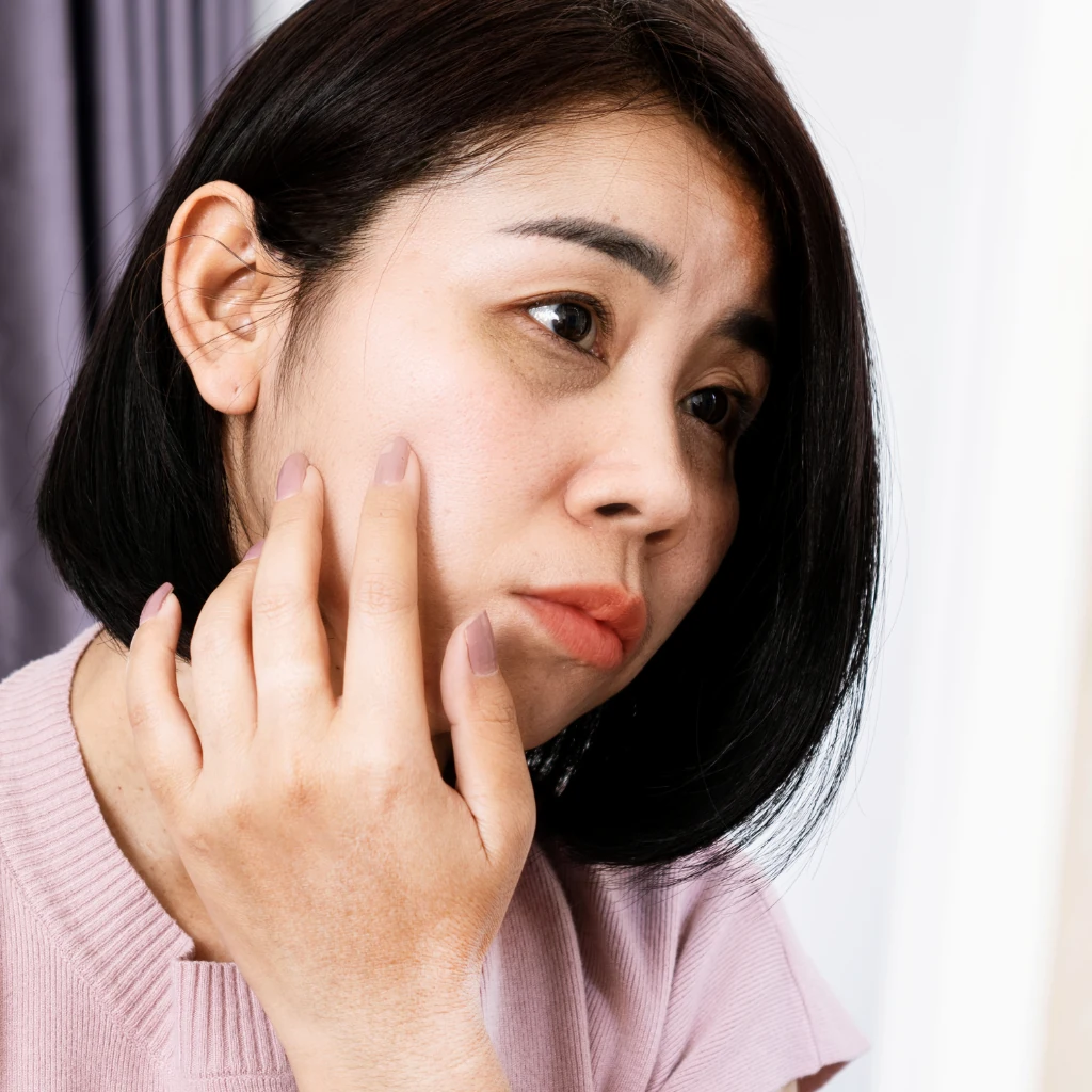 How to Remove Dark Circles Permanently (What Actually Works)