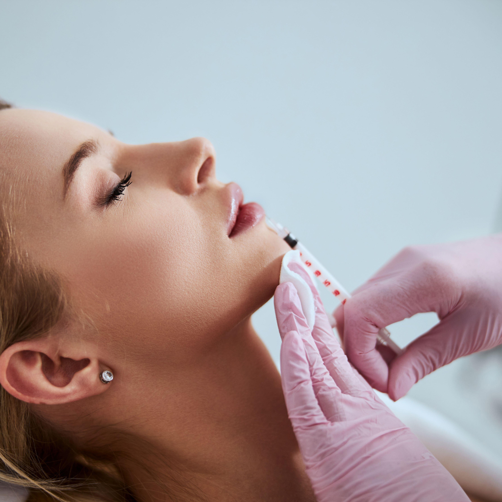 Dermal Fillers Marionette Lines: Transform Your Lower Face