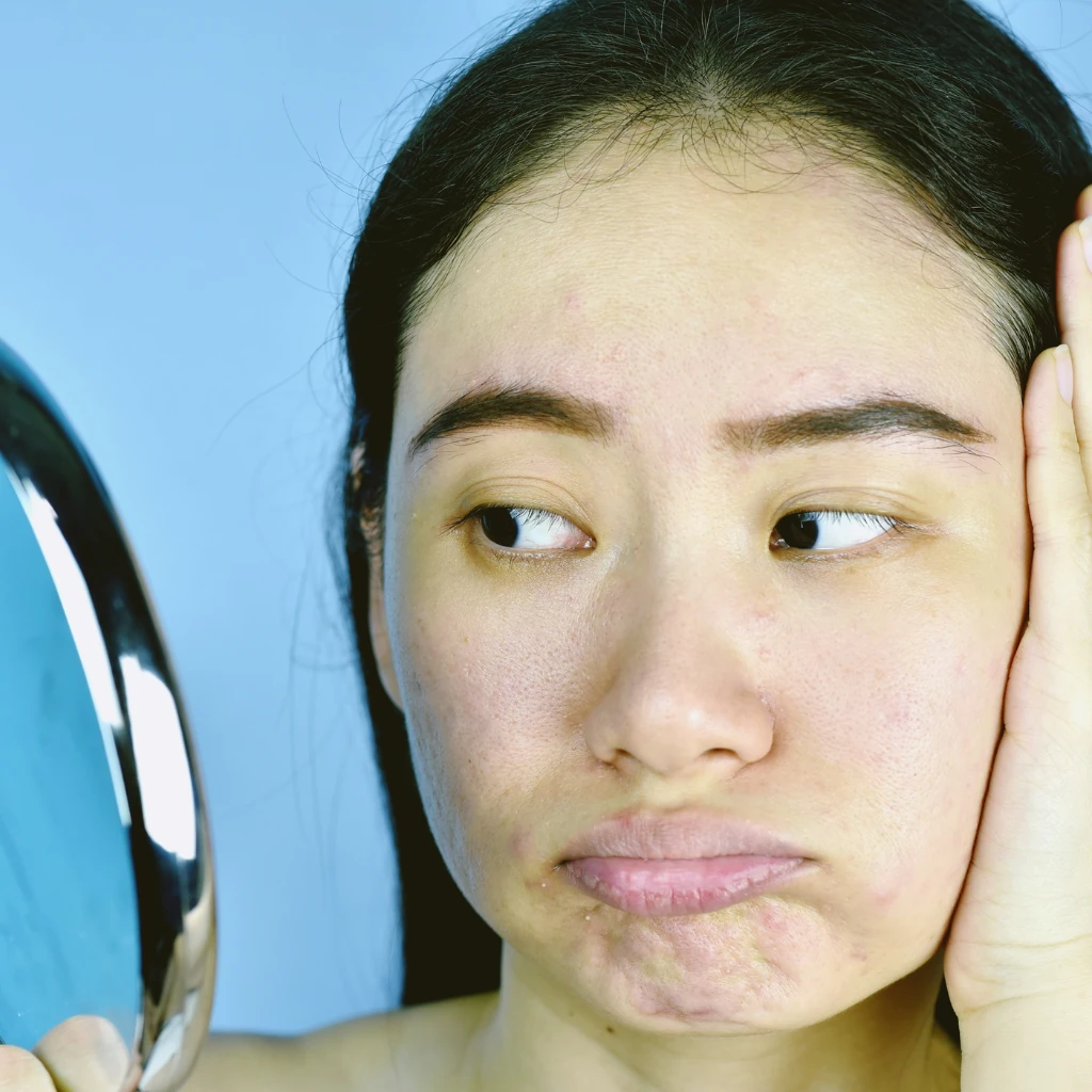 How to Brighten Dull Skin Naturally and Restore Radiance