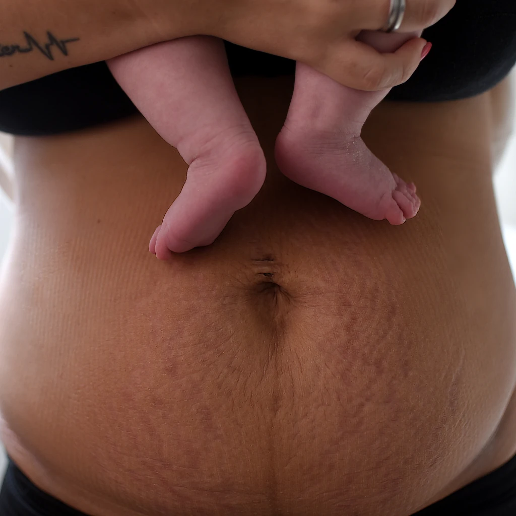 Why Is a Postpartum Skincare Routine Crucial for Healthy Skin?
