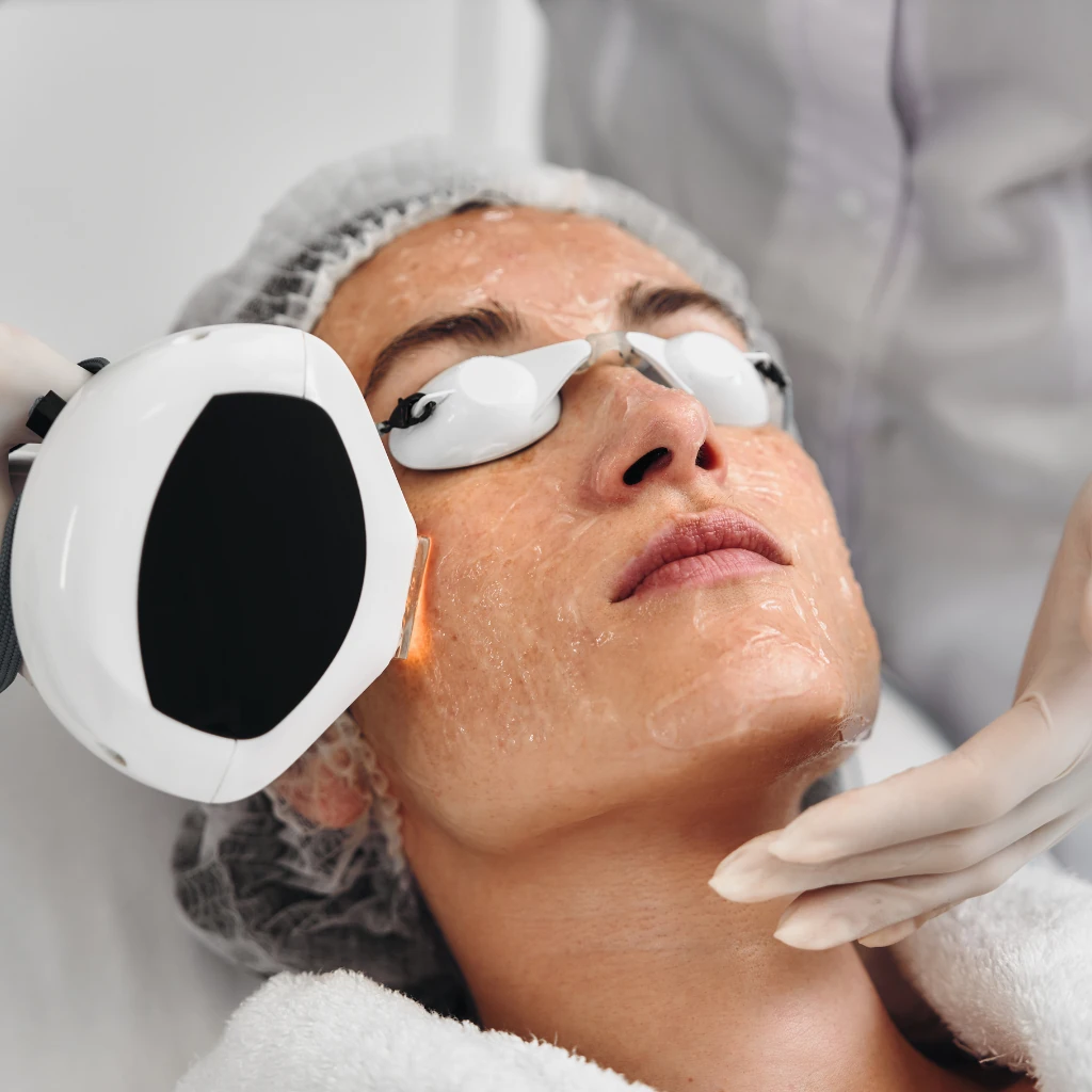How can you remove tan from your face and body? Best ways to remove tan