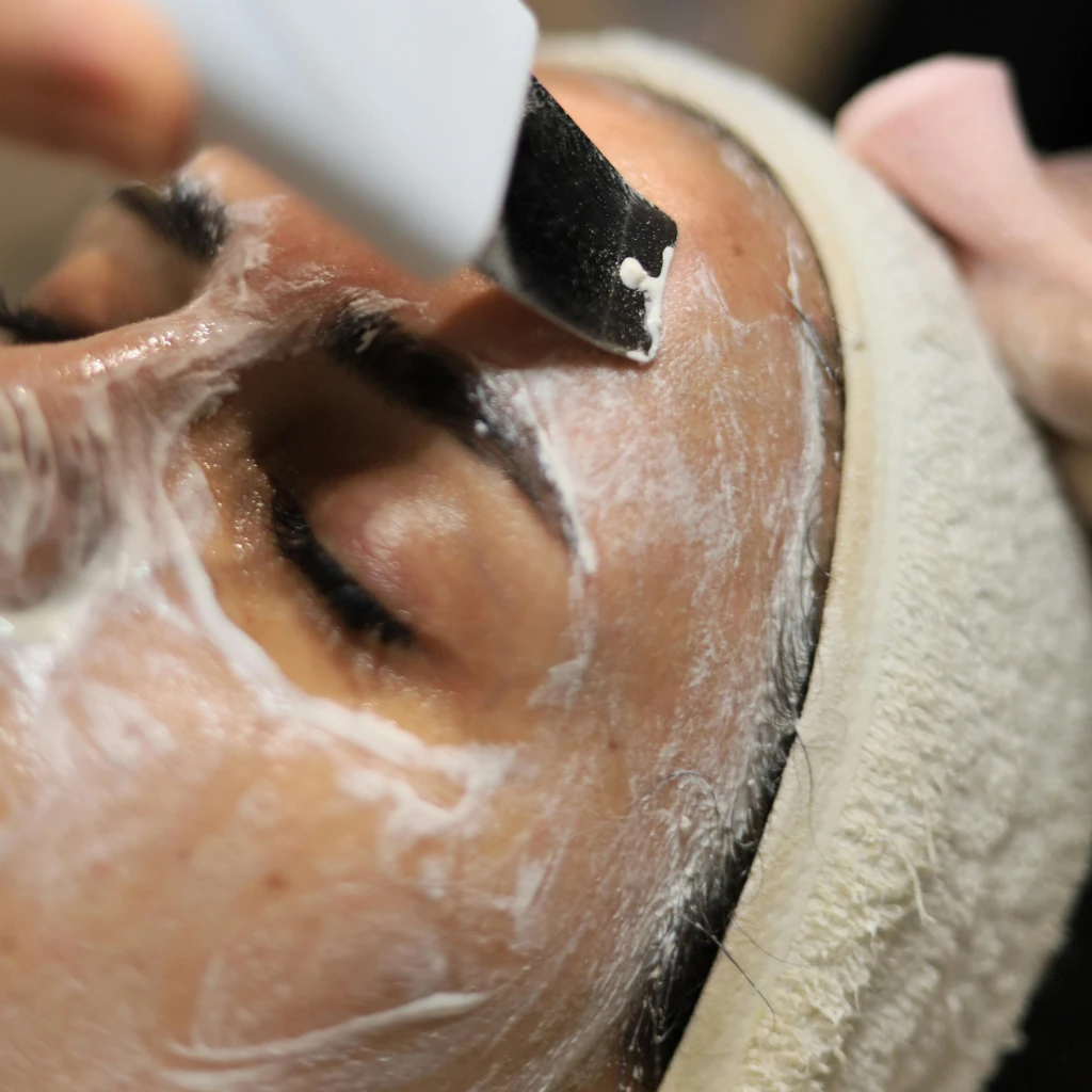 How Can You Remove Dull Skin and Brighten Your Face With Treatment?