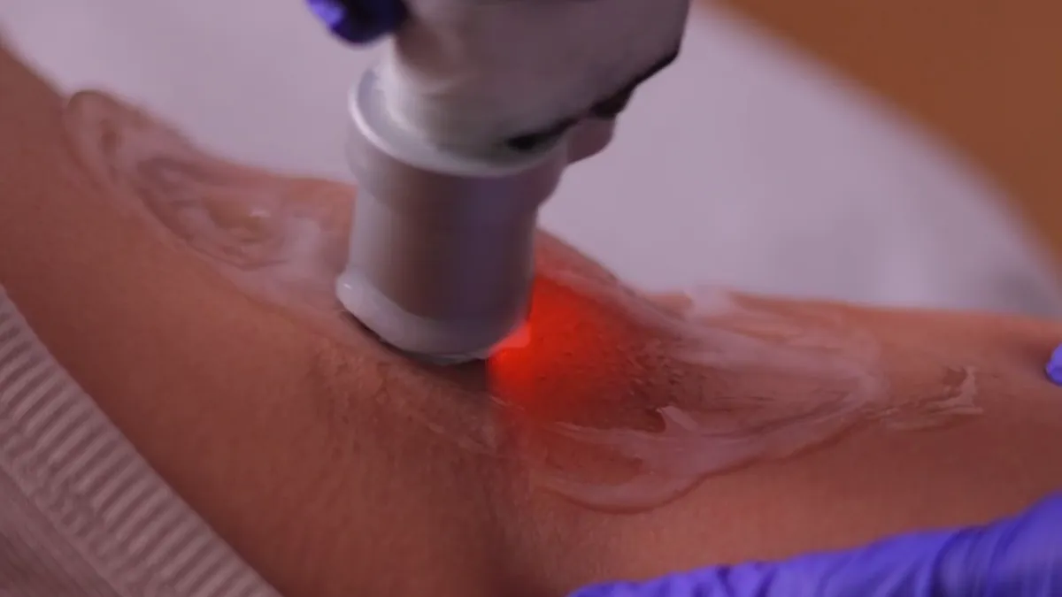 Underarm Whitening: Causes of Dark Underarms & Treatment