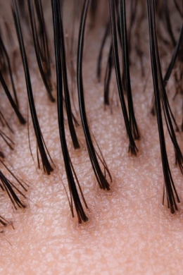 Stronger hair roots after regrowth treatment