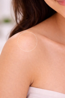 Better skin finish after mole removal