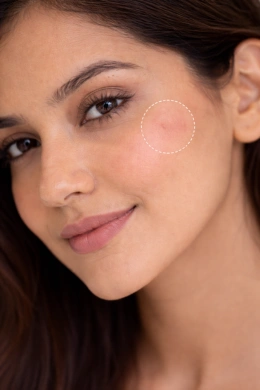 Clean skin healing after mole removal