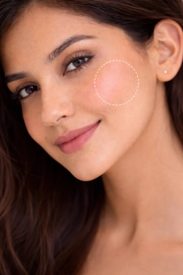 Refined skin texture after open pores treatment