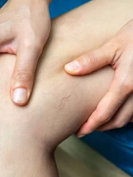 A person holding up a little skin patch on their knee, concisely demonstrating a quick process.