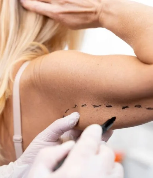 A skin care doctor marks a patient's hand with a block sketch as the patient receives skin-therapy.