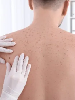 A doctor checks a guy's neck for signs of skin cancer, urging for a lower chance of getting it.