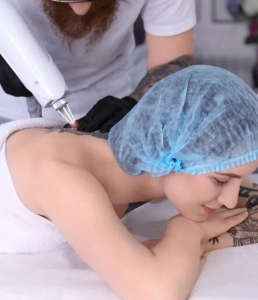 A woman geting laser skin care treatment from skin care experts to get rid of tattoos on her body.