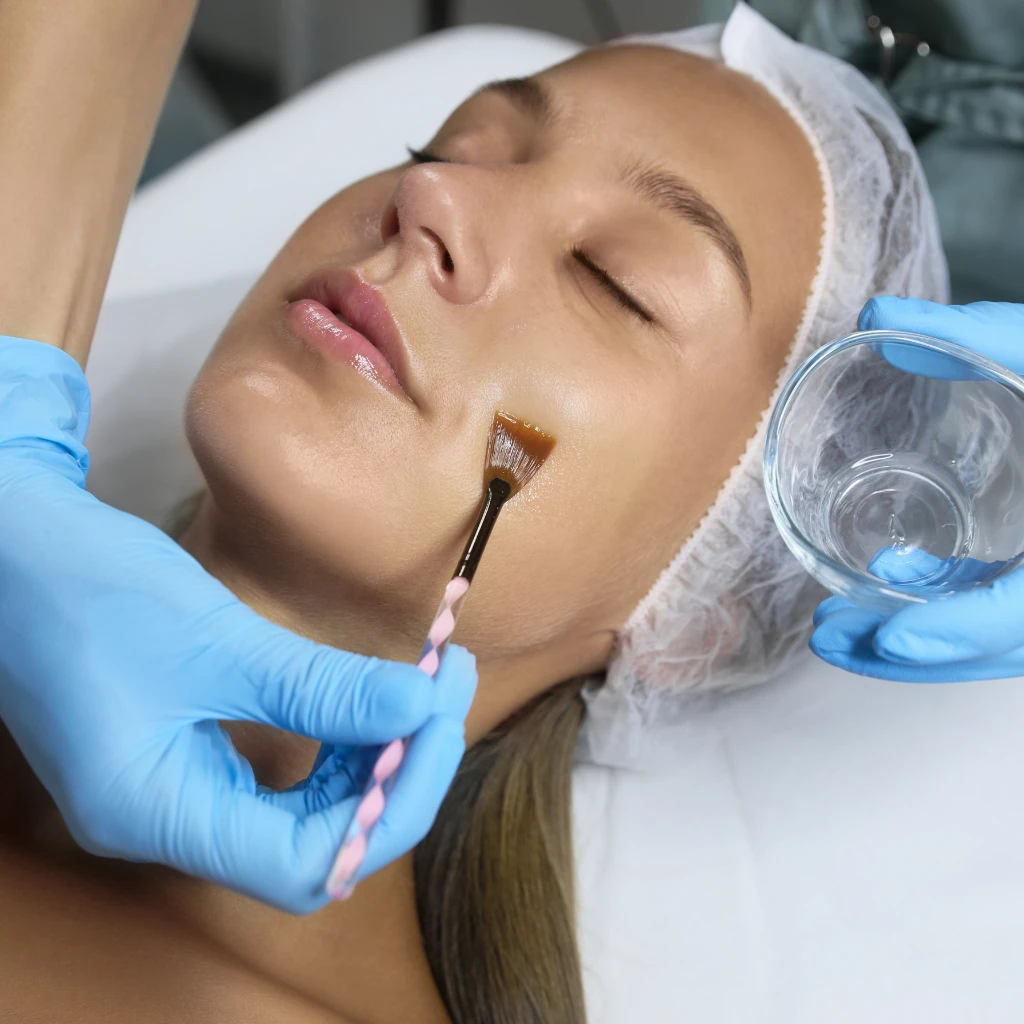 Chemical Peels for Tan Removal