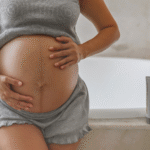 How to Prevent Stretch Marks During Pregnancy and Reduce Pregnancy Scars