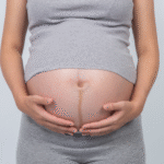 How to Treat Red Stretch Marks: Causes and Treatment for Smoother Skin
