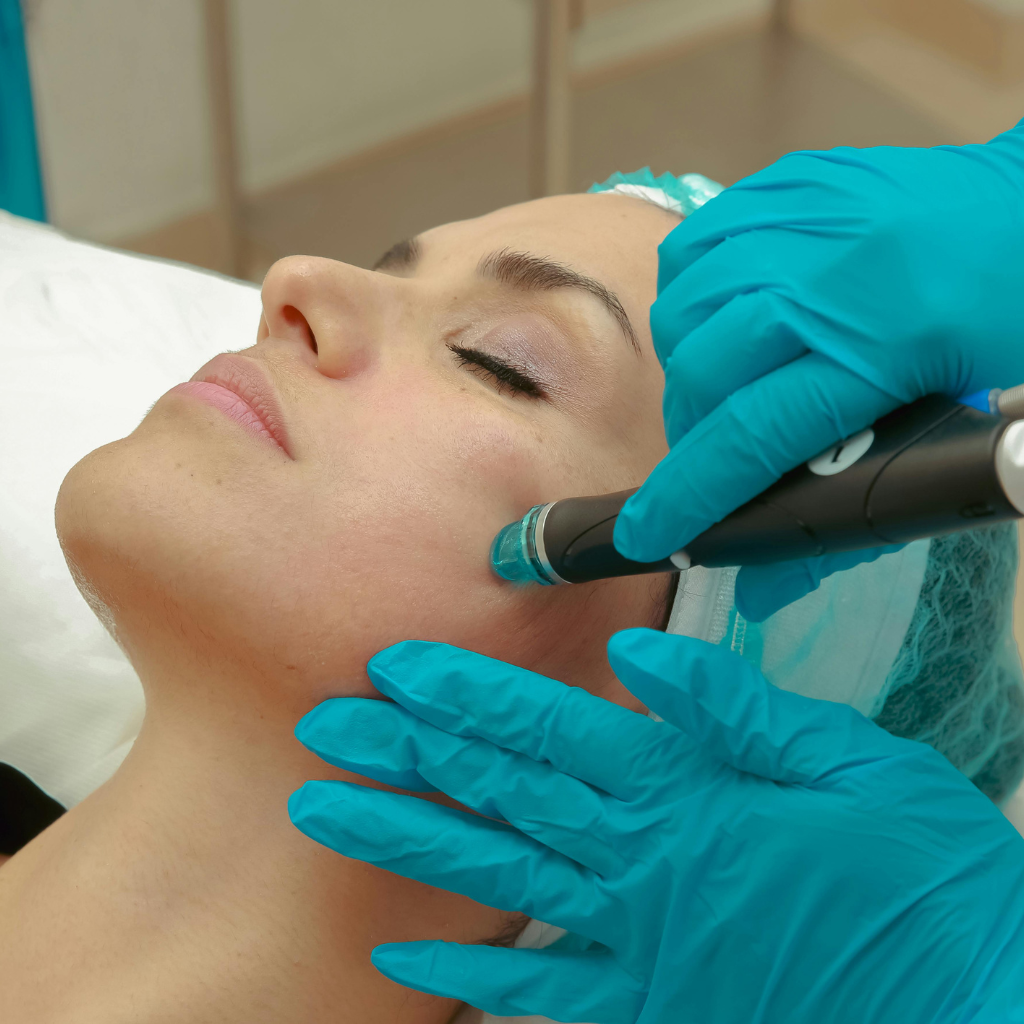 does hydrafacial remove tan