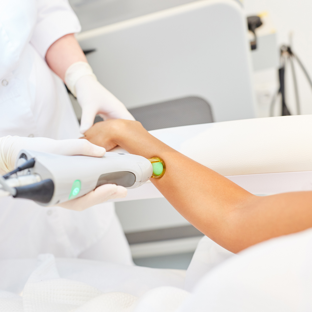 types of laser hair removal