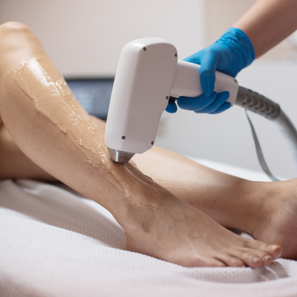 laser hair removal vs waxing