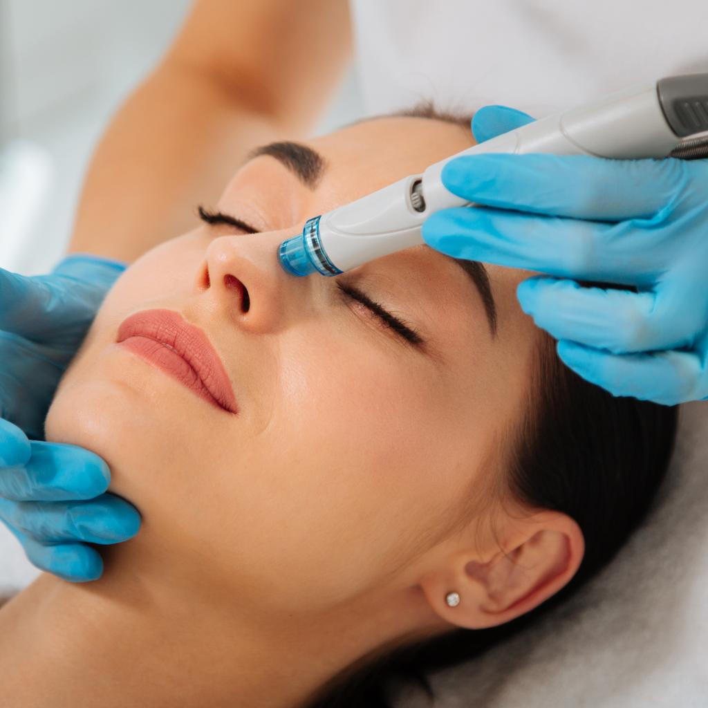 do hydrafacials get rid of blackheads