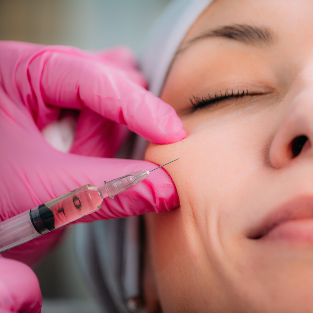 longest lasting dermal filler for cheeks