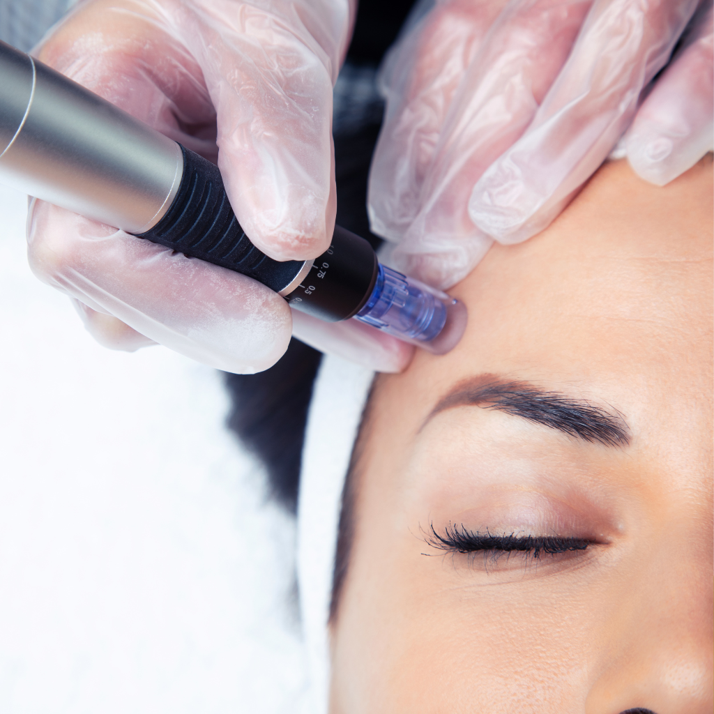 hydrafacial vs microneedling for wrinkles