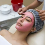 Chemical Peel for Pimples: Is It Right for Your Skin?